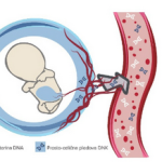 NIFTY test NIPT ZC Dravlje